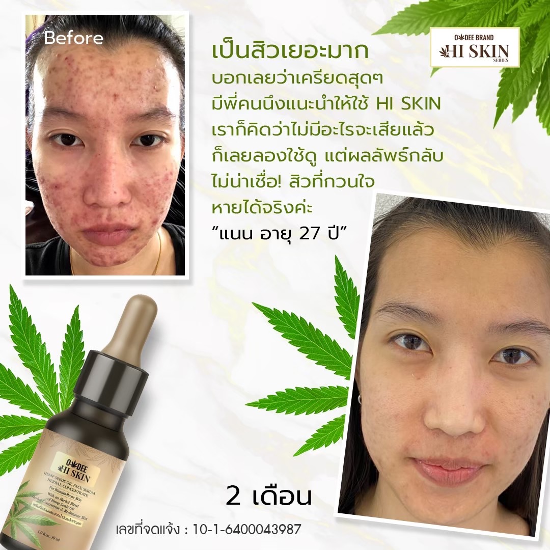 โอดี ไฮ สกิน เฮมพ์ ซีด ออยล์ เฟส เซรั่ม เฮอร์เบิล คอนเซนแทรก 30 มล. - Image 6