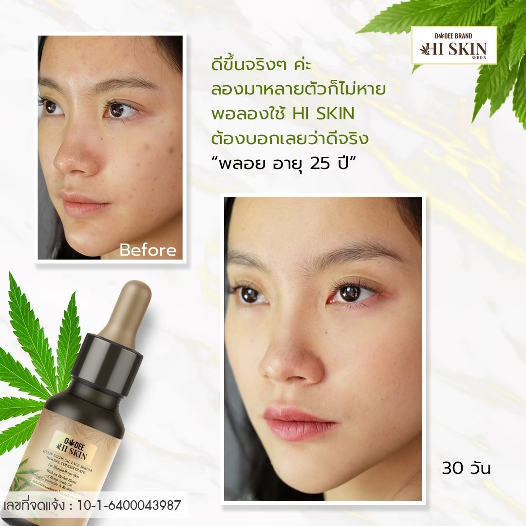 โอดี ไฮ สกิน เฮมพ์ ซีด ออยล์ เฟส เซรั่ม เฮอร์เบิล คอนเซนแทรก 30 มล. - Image 5