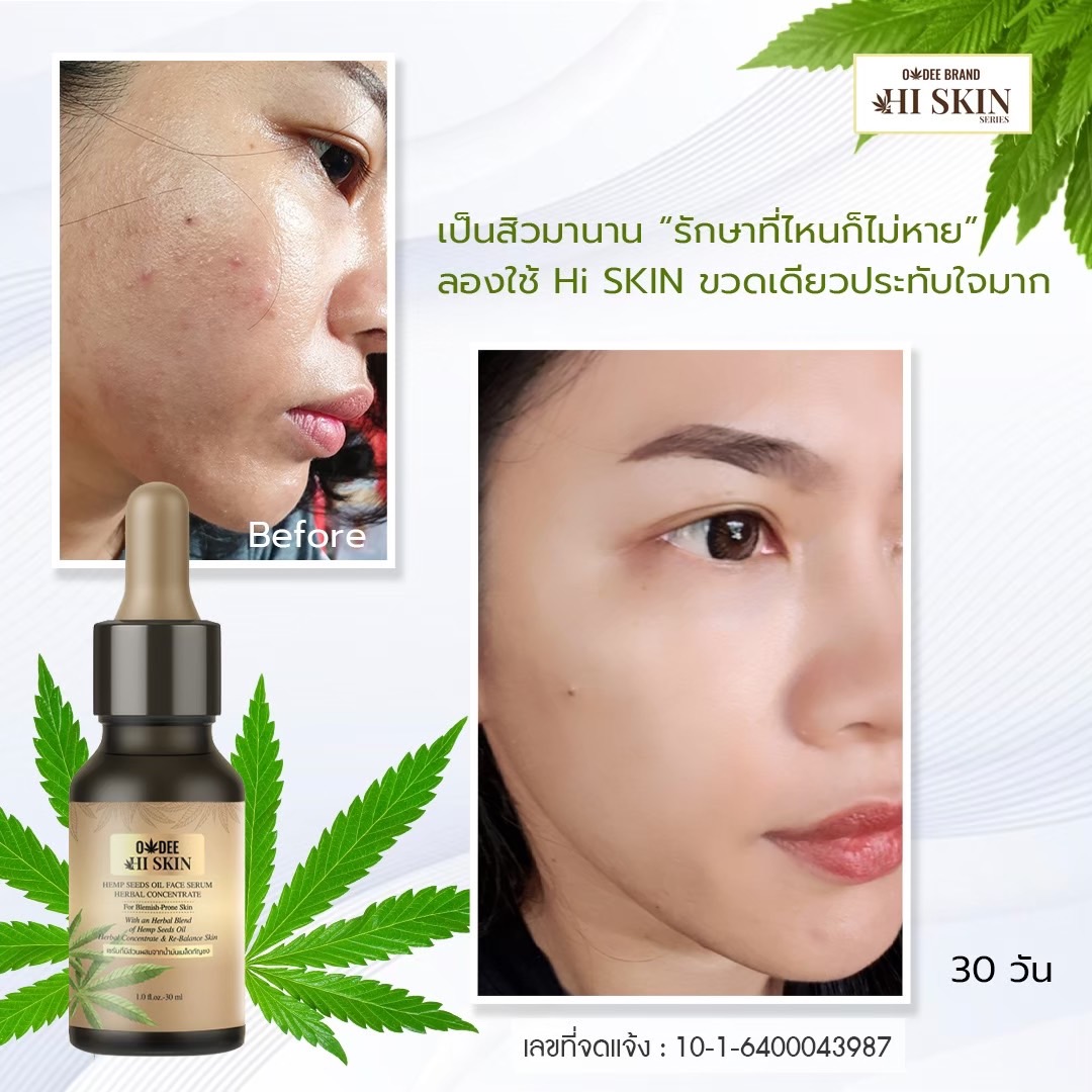 โอดี ไฮ สกิน เฮมพ์ ซีด ออยล์ เฟส เซรั่ม เฮอร์เบิล คอนเซนแทรก 30 มล. - Image 4
