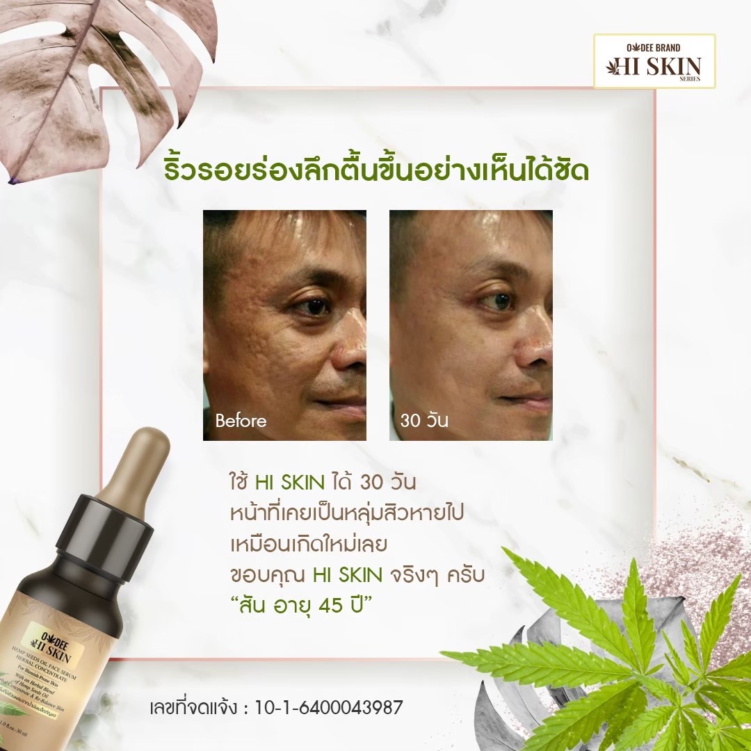โอดี ไฮ สกิน เฮมพ์ ซีด ออยล์ เฟส เซรั่ม เฮอร์เบิล คอนเซนแทรก 30 มล. - Image 11